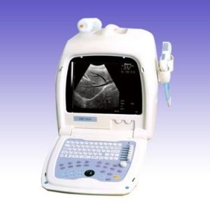 RS0241 Ultrasound Scanner Machine Model EMP-860