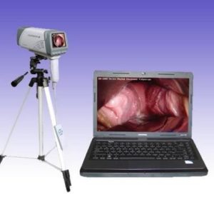 RS0280 Digital Electronic Video Colposcope SM-DMC
